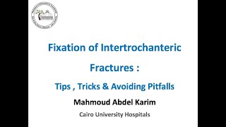 Fixation of Intertrochanteric Fractures Tips , Tricks \u0026 Avoiding Pitfalls