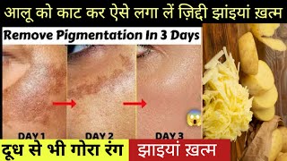 How to Remove Dark Spots Using Potato / Reduce Melasma, Pigmentation, Discolouration, Blackspots