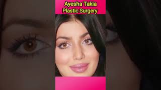 Ayesha Takia Plastic Surgery Failed