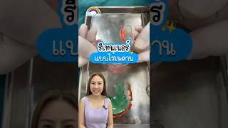 รีเทนเนอร์แบบไร้เพดาน | คลินิกทันตกรรมฟ้าใส | จัดฟันระยอง