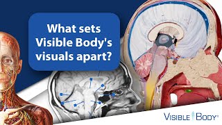 What sets Visible Body's visuals apart?