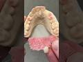 Flipper Partial #teeth #dental #smile #lsk121shorts #shortvideo #shorts @EnvisiontecMain#envisiontec