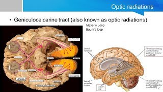 Neurosurgery written board crash course - visual cortex and visual processing