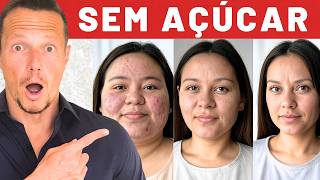 O Que Acontece No Corpo Em 60 Dias SEM Açúcar? (Sem Tirar o Doce)