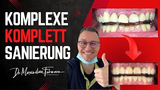 🦷 Komplexe Komplettsanierung bei Bruxismus \u0026 Abrasionen | Systematische Prothetik-Strategie