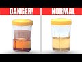 What Your Pee Color Says About Your Health! 🚽💧 | Health Secrets Revealed