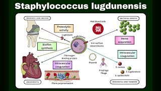 Staphylococcus lugdunensis: A Comprehensive Guide to This Pathogen | Superbug Hiding on Your Skin