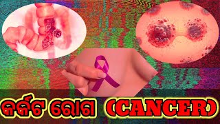 CANCERS (କର୍କଟ ରୋଗର) SYMPTOMS, TREATMENT Urban PHC,Angul (Mishrapada)