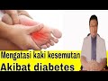 Cara mengatasi kaki kesemutan akibat diabetes