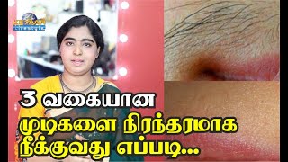 Remove Facial Hair Permanently - 2 | hair removal at home in tamil |  Tamil Beauty Tips