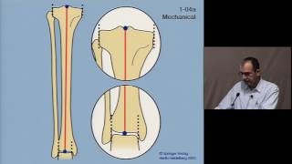 Normal Alignment & Orientation