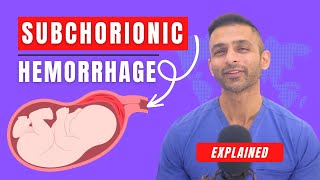 Subchorionic Hemorrhage Explained | Causes \u0026 Treatment #womenshealth #miscarriage #pregnancy