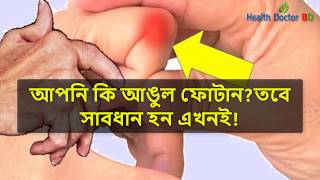 আপনি কি আঙুল ফোটান? সাবধান! ঘটে যেতে পাড়ে মারাত্বক বিপদ