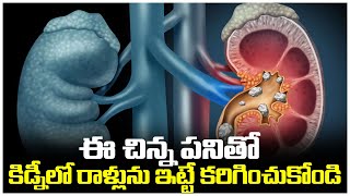 ఈ చిన్న పనితో కిడ్నీలో రాళ్లను ఇట్టే కరిగించుకోండి!! || Home Remedies For Kidney Stone || Gold Star