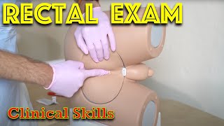 Rectal Examination and Prostate Exam - Digital Rectal Exam (DRE) - Medical School Clinical Skills