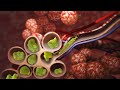 Pneumonia | Discharge Instructions | Nucleus Health Pneumonia | Discharge Instructions | Nucleus Health