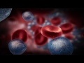What is Multiple Myeloma