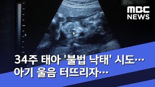 34주 태아 '불법 낙태' 시도…아기 울음 터뜨리자… (2019.10.29/뉴스데스크/MBC)