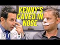 Kenny's Rhinoplasty Gone Wrong: Nose COLLAPSES After Botched Nose Job | Botched | E!