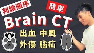 【Brain CT判讀】你只需要看這部！一次搞懂腦部電腦斷層！如何不會遺漏Brain CT上重要的病灶？出血、中風、外傷、Mass effect、herniation sign、腦瘤！正常結構導覽！