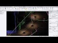 What's new in TBC 5.30 - Automatic Pole/Sign Extraction