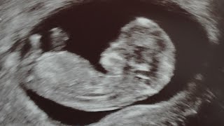 #11 TYDZIEŃ CIĄŻY. Badania prenatalne