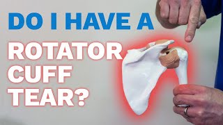 Do I have rotator cuff tear and is surgery necessary?