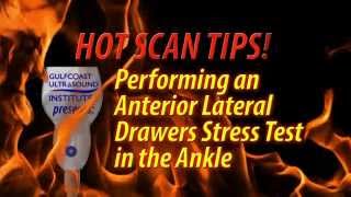 Hot Tip -  Performing an Anterior Lateral Drawers Stress Test in the Ankle