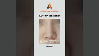 Blunt Tip Correction | Answer Plastic Surgery #shorts #blunttipcorrection