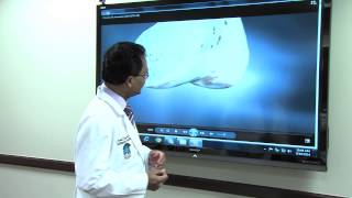 St. Mary's - Knee Replacement 3D Printing