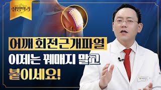 어깨 회전근개파열, 이제는 꿰매지 마세요! (콜라겐 임플란트) @제애정형외과병원 서희수 대표원장