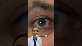 STOP Ignoring These EYE Risks with Rheumatoid Arthritis