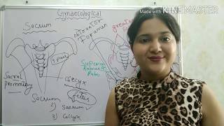 FEMALE PELVIS || GYNAECOLOGICAL NURSING|| EASY EXPLANATION||