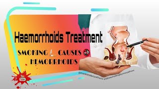 SMOKING 🚬 CAUSES 🚭 HEMORRHOIDS | Internal and external Hemorrhoids| Hemorrhoids treatment #health