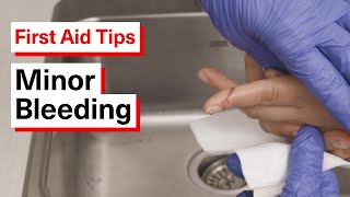 How to Help Someone with Minor Bleeding | First Aid Tips