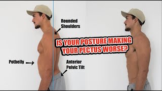 Is Bad Posture Making your Pectus WORSE!?