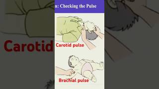 carotid and brachial pulse #nursingcompetition