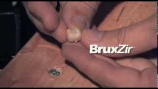 Dental Crown Hammer Test