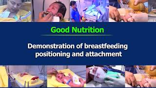 Demonstration of breastfeeding positioning and attachment