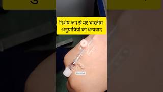 Iv cannulation technique ||Cannula insertion technique|| Intravenous cannula method || Cannulation