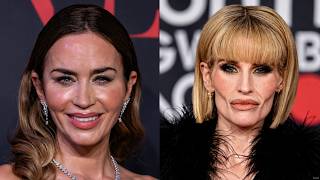 Celebrities Who Got SO UGLY After Plastic Surgery