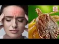 scrub typhus disease in odia symptoms treatment how to identify scrub typhus insect microbiology