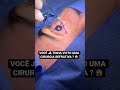 Você já tinha visto uma cirurgia refrativa? 👁👁