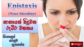 Nose bleeding/ නාසයෙන් රුධිර වහනය විමේ ආබාධ/ Epistaxis/ how it happens/ causes/ symptoms/ treatments