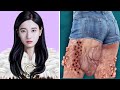 ASMR Remove Big Acne & Worm Infected Leg | Severely Injured Animation