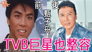 7位TVB巨星整容前後！所有人都割過雙眼皮，還有人動過鼻子，太讓人意想不到！#古巨基#成龍#甄子丹#張學友#林峯#黃金年代