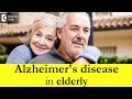 Alzheimer's disease in elderly - Dr. Sharat Honnatti