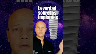 Ahora TODOS quieren estos IMPLANTES