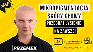 Pożegnaj łysienie na zawsze! Mikropigmentacja Skóry Głowy! KLINIKA SMP