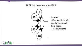 Monitoreo Básico de la Ventilación Mecánica Parte !